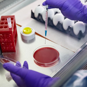 Fact checking highly pathogenic avian influenza (HPAI)