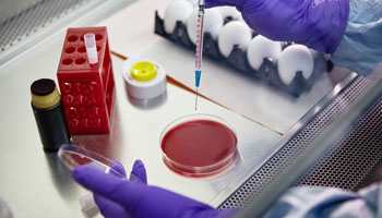 Fact checking highly pathogenic avian influenza (HPAI)