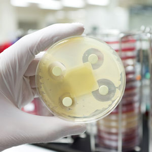 Collaborer pour lutter contre les superbactéries : le projet Résistance aux antimicrobiens - Une seule santé