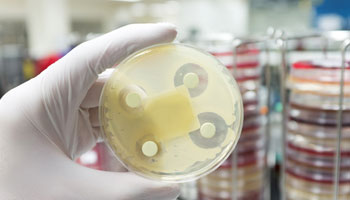 Collaborating to combat superbugs: the GRDI AMR-One Health Project