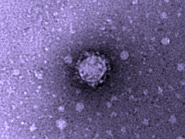 An electron microscope image of the HIV virus.