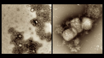 Photo of the monkeypox/mpox virus imaged on an electron microscope.