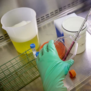 Des scientifiques font équipe afin de faire avancer la recherche sur les traitements par anticorps contre des maladies mortelles